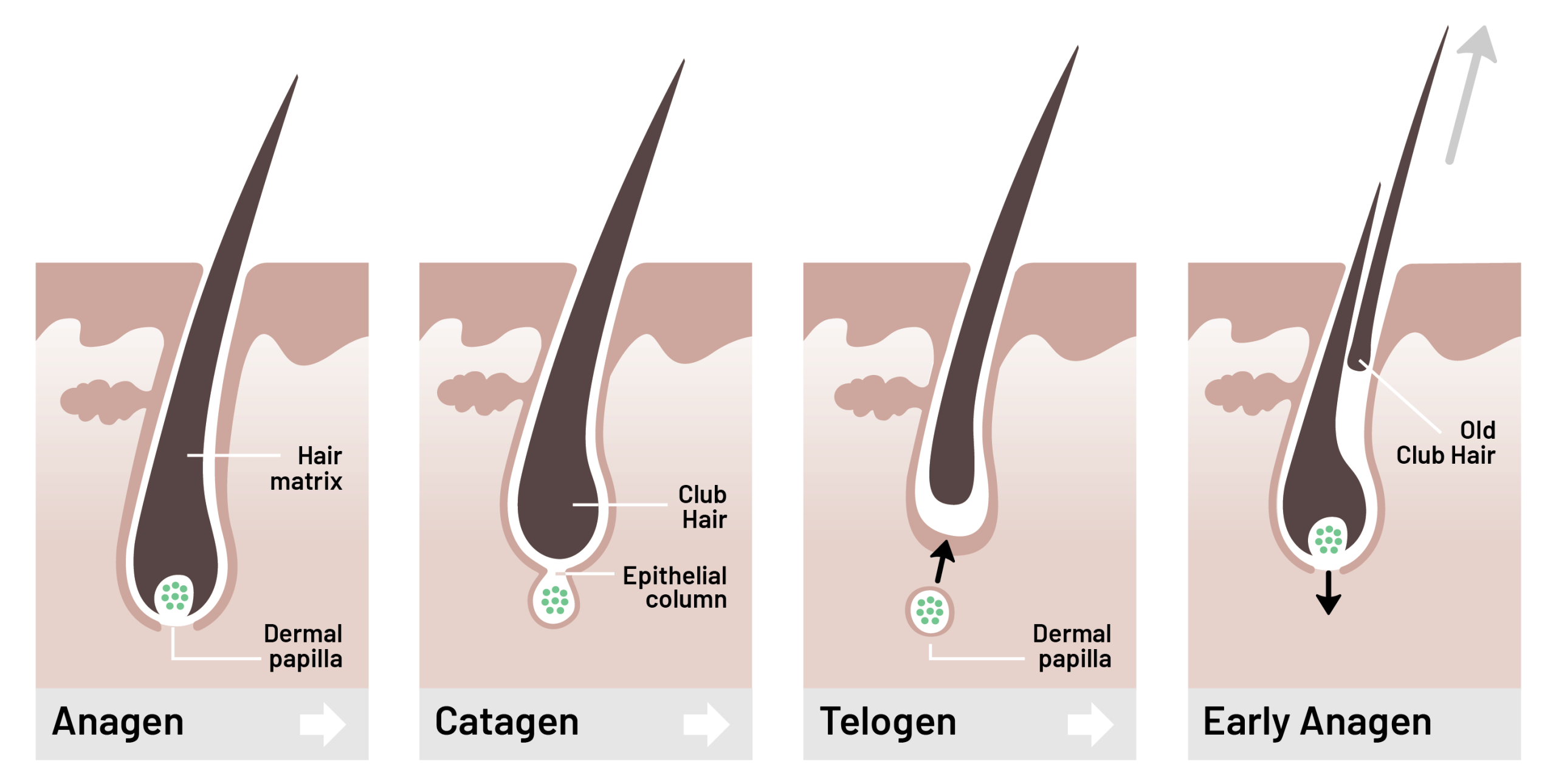 GL_HairDiagram_ALL4